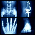 Digital X-ray at Edge Imaging