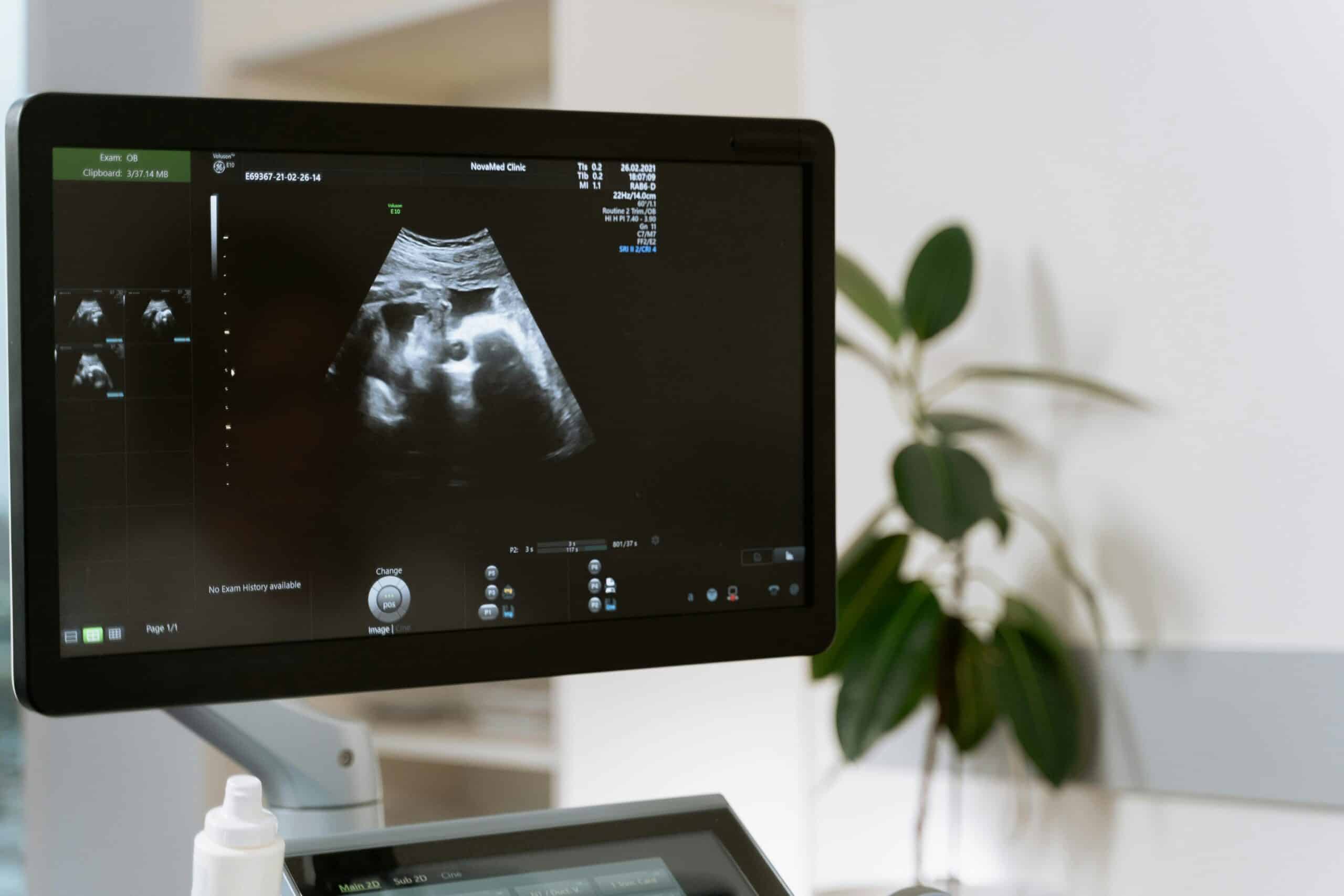 Best Ultrasound Care in Noida: Top-Quality Diagnostic Services