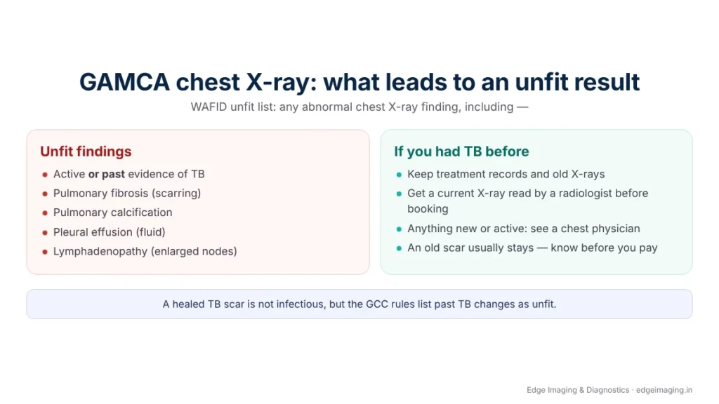 GAMCA chest X-ray unfit findings: active or past TB, pulmonary fibrosis, calcification, pleural effusion and lymphadenopathy, with steps to take if you had TB before