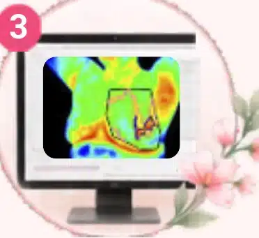 Thermal image on a monitor analysed by AI and reviewed by a doctor